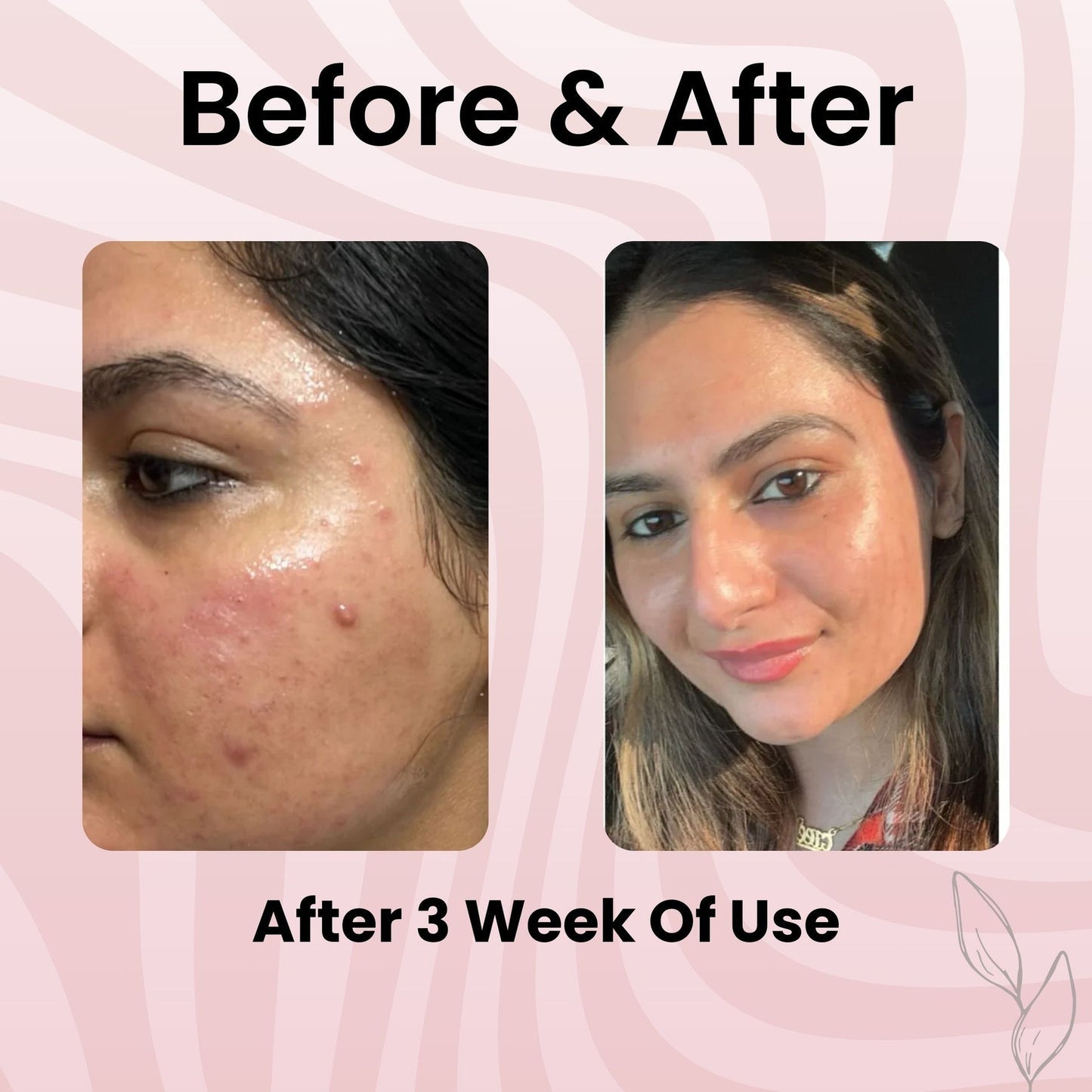 Korean Collagen Wrapping Mask™